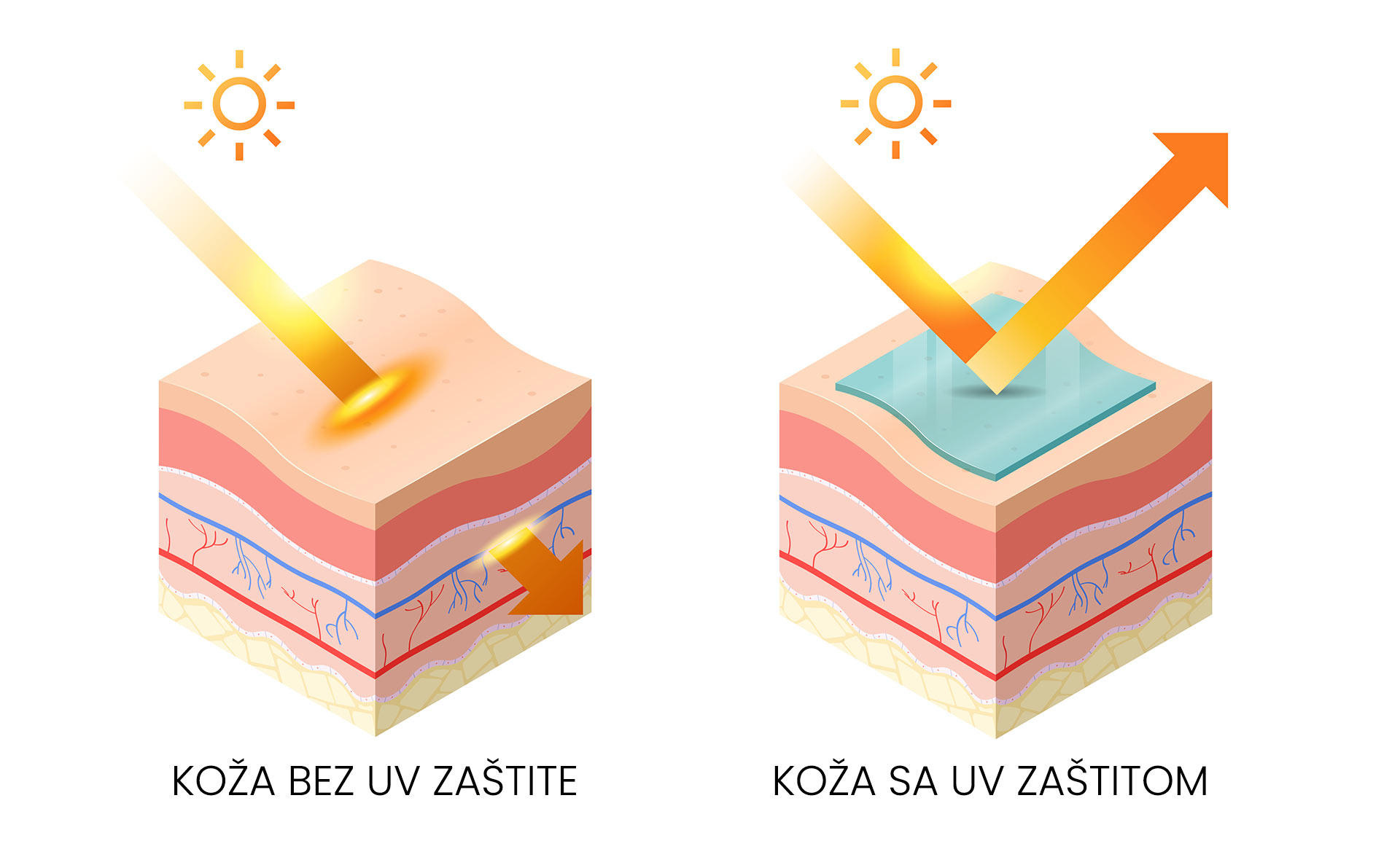 Koža bez UV zaštite vs. koža s UV zaštitom